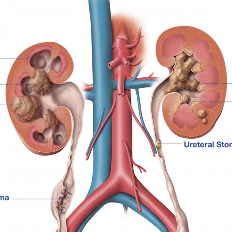 urology anatomy poster